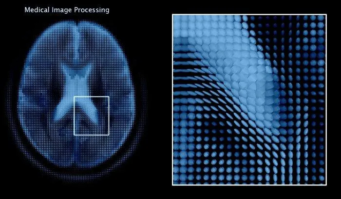 Medical image analysis